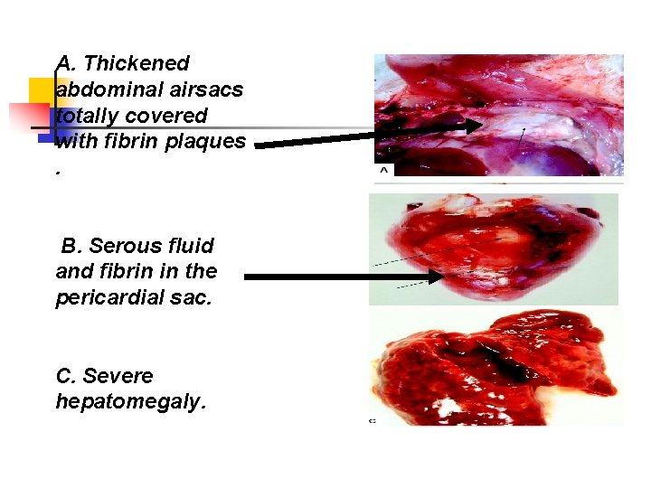 A. Thickened abdominal airsacs totally covered with fibrin plaques. B. Serous fluid and fibrin