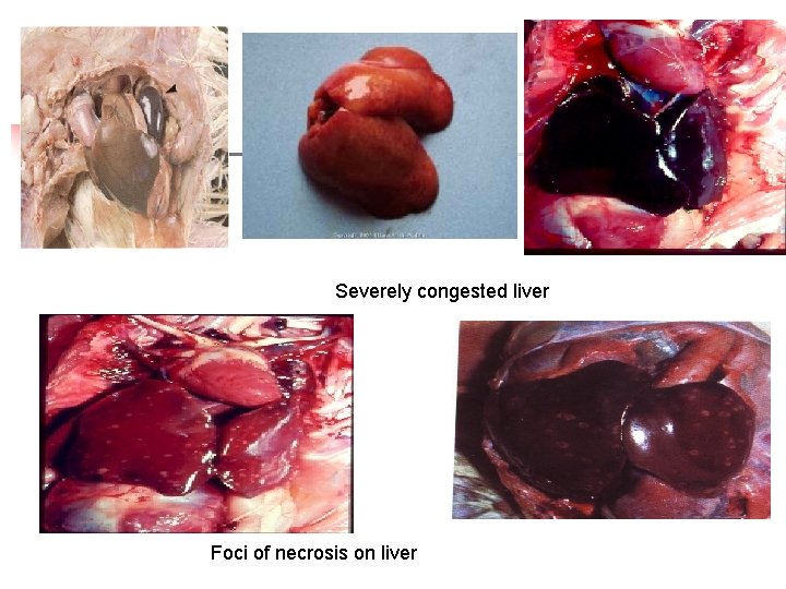 Severely congested liver Foci of necrosis on liver 