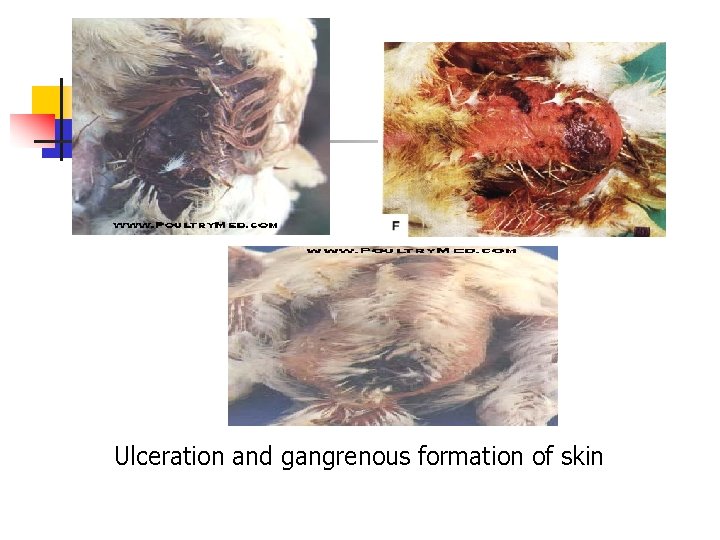 Ulceration and gangrenous formation of skin 
