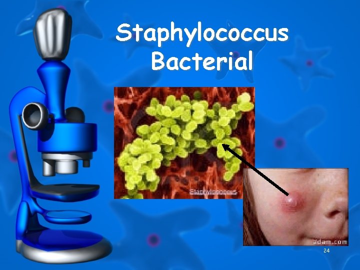 Staphylococcus Bacterial 24 