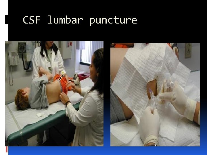 CSF lumbar puncture 