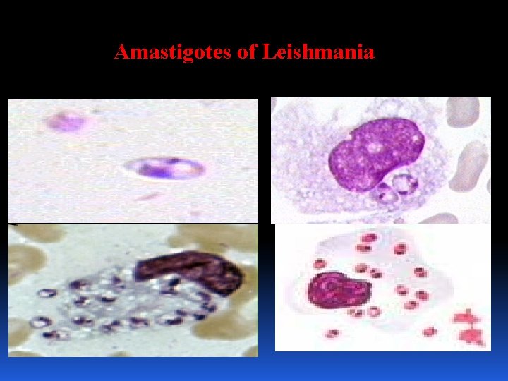 Amastigotes of Leishmania 