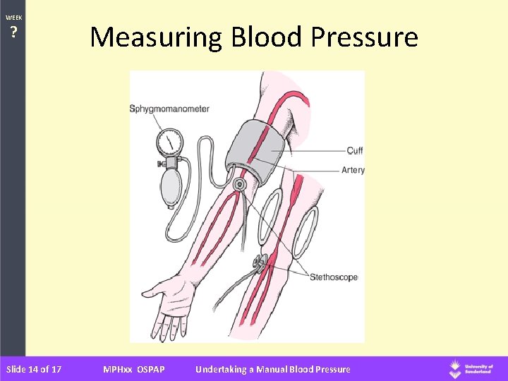 WEEK ? Slide 14 of 17 Measuring Blood Pressure MPHxx OSPAP Undertaking a Manual