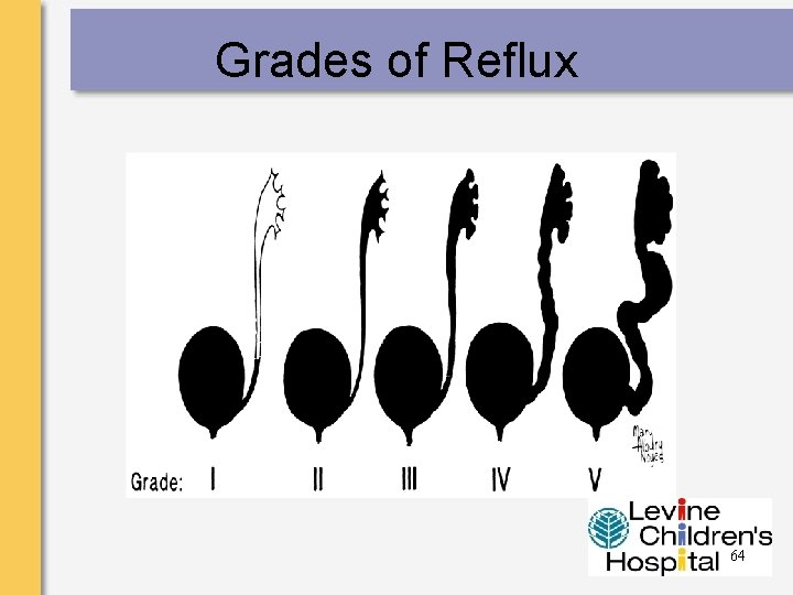 Grades of Reflux 64 
