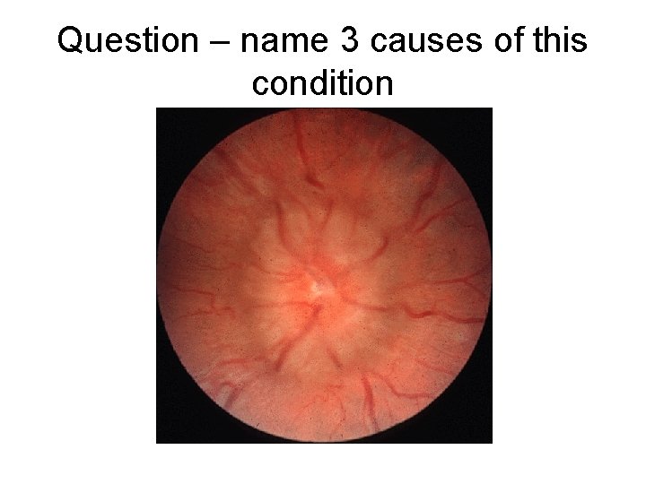 Question – name 3 causes of this condition 