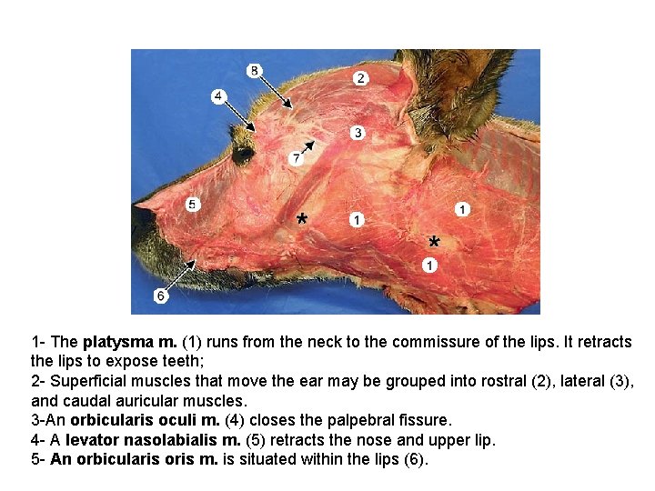 1 - The platysma m. (1) runs from the neck to the commissure of