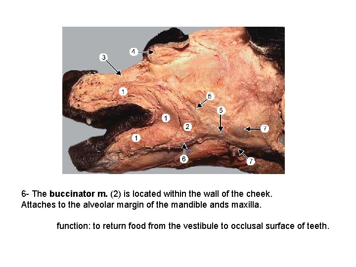 6 - The buccinator m. (2) is located within the wall of the cheek.