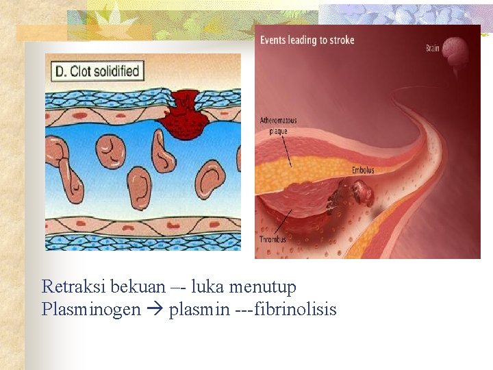 Retraksi bekuan –- luka menutup Plasminogen plasmin ---fibrinolisis 