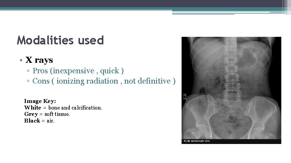 Modalities used • X rays ▫ Pros (inexpensive , quick ) ▫ Cons (