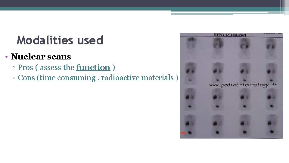 Modalities used • Nuclear scans ▫ Pros ( assess the function ) ▫ Cons