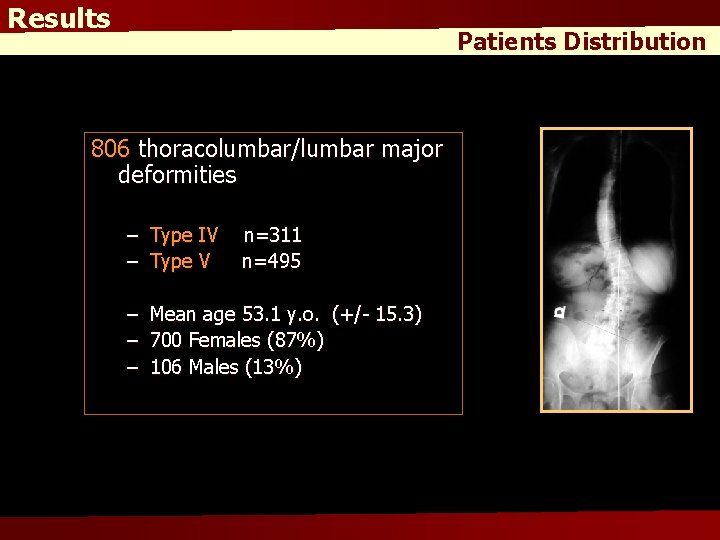 Results Patients Distribution 806 thoracolumbar/lumbar major deformities – Type IV – Type V –