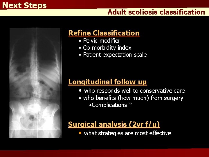 Next Steps Adult scoliosis classification Refine Classification • Pelvic modifier • Co-morbidity index •