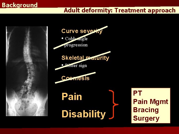 Background Adult deformity: Treatment approach Curve severity • Cobb angle • progression Skeletal maturity