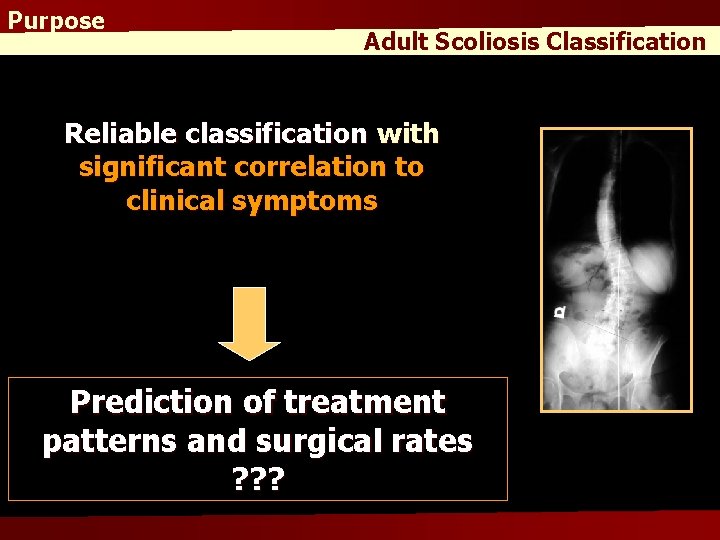 Purpose Adult Scoliosis Classification Reliable classification with significant correlation to clinical symptoms Prediction of