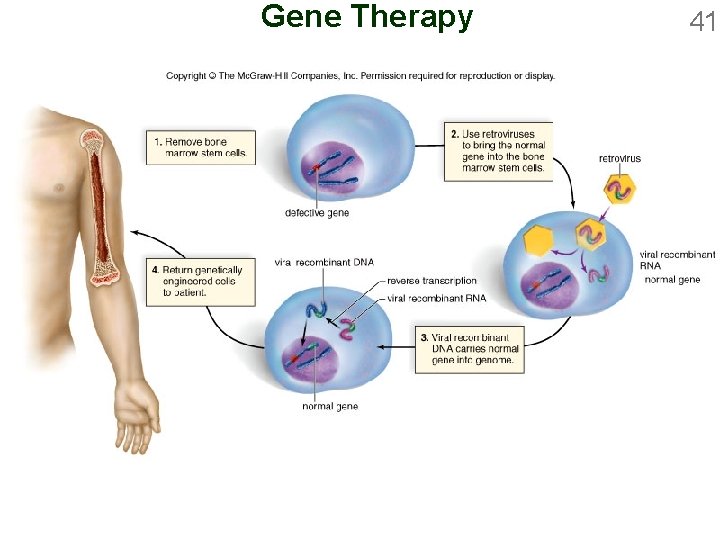 Gene Therapy 41 