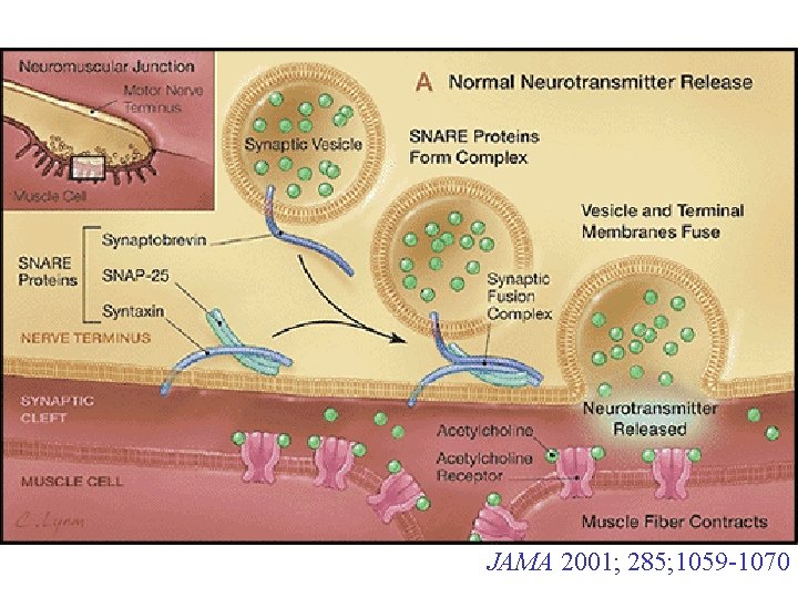 JAMA 2001; 285; 1059 -1070 