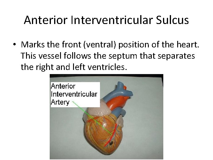 Anterior Interventricular Sulcus • Marks the front (ventral) position of the heart. This vessel