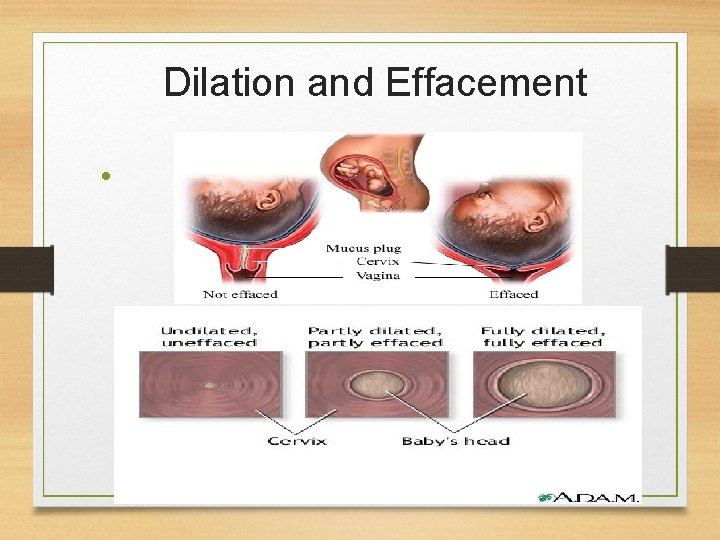 Dilation and Effacement • 9/26/2020 10 