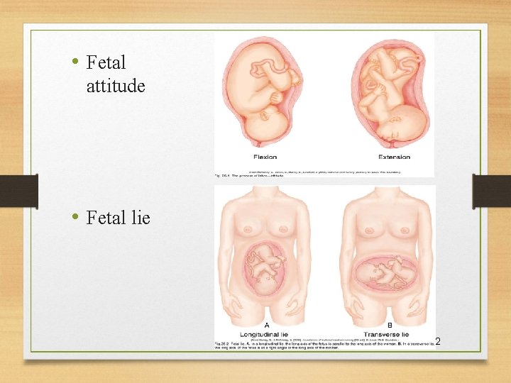  • Fetal attitude • Fetal lie 9/26/2020 12 