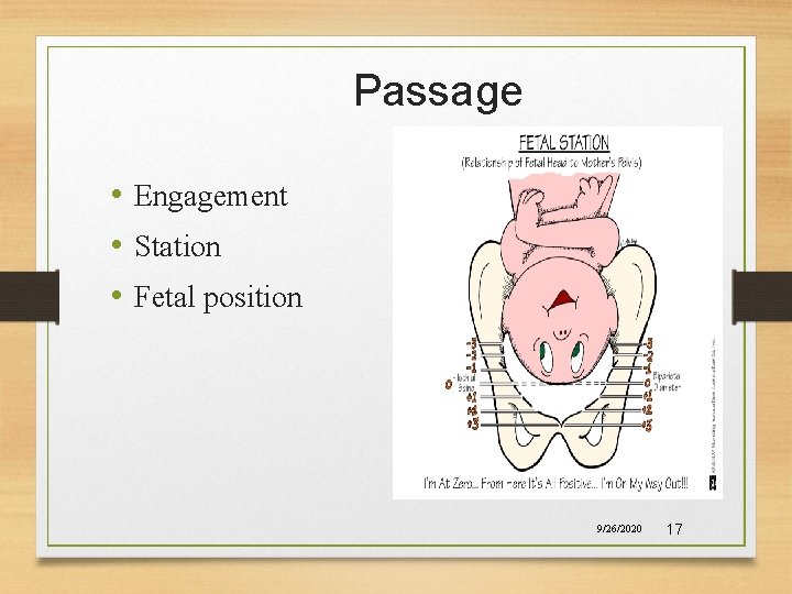 Passage • Engagement • Station • Fetal position 9/26/2020 17 