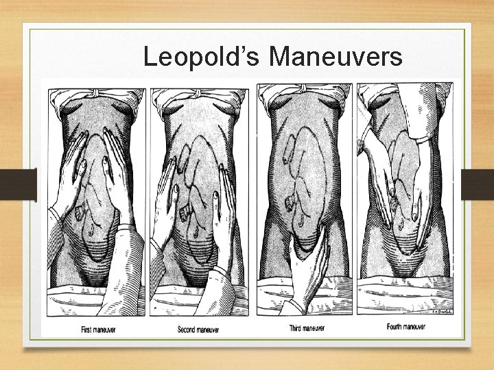 Leopold’s Maneuvers 9/26/2020 22 