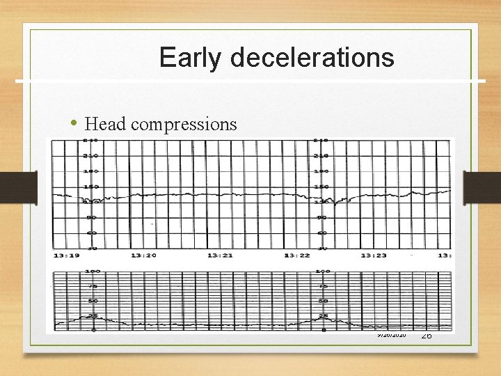 Early decelerations • Head compressions 9/26/2020 26 