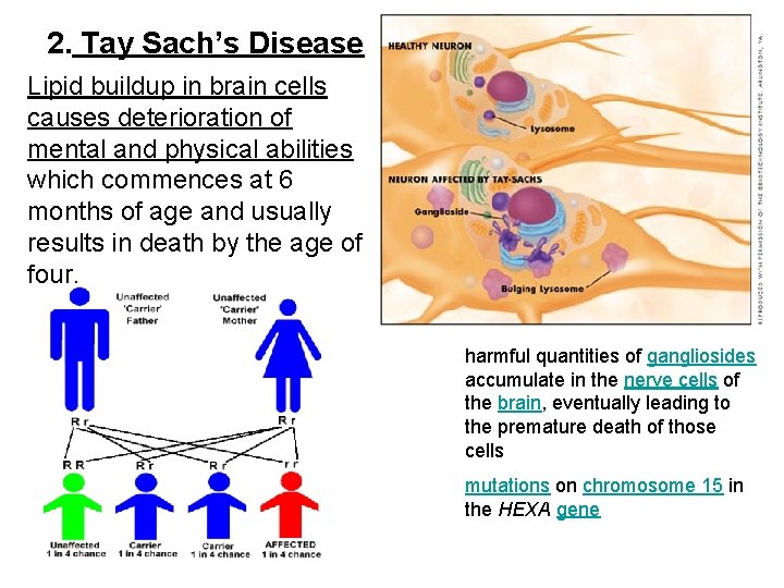 2. Tay Sach’s Disease Lipid buildup in brain cells causes deterioration of mental and