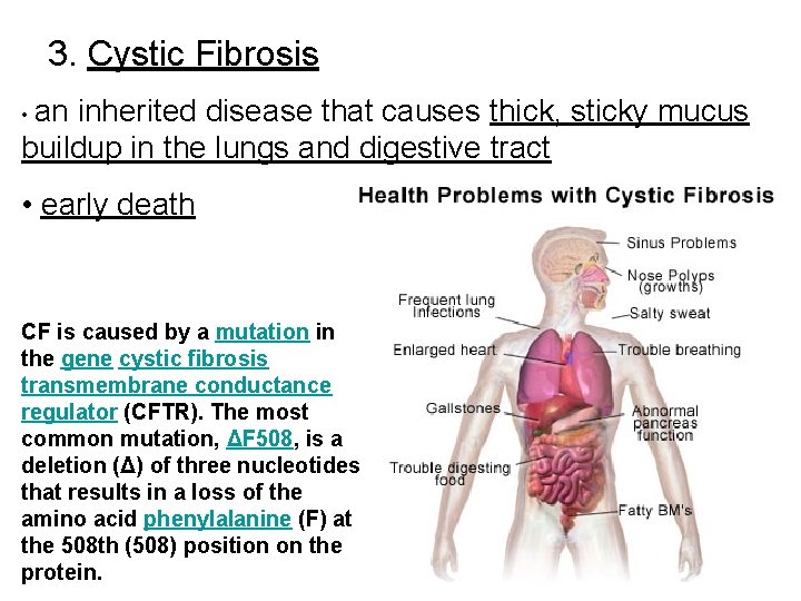 3. Cystic Fibrosis • an inherited disease that causes thick, sticky mucus buildup in