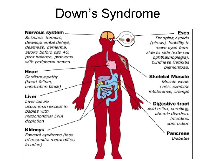 Down’s Syndrome 