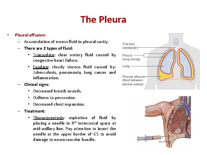 The Pleura • Pleural effusion: – Accumulation of excess fluid in pleural cavity. –