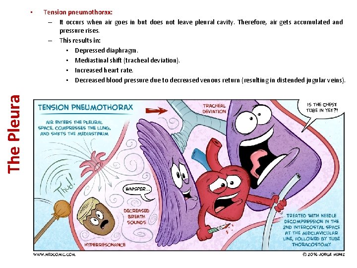 The Pleura • Tension pneumothorax: – It occurs when air goes in but does