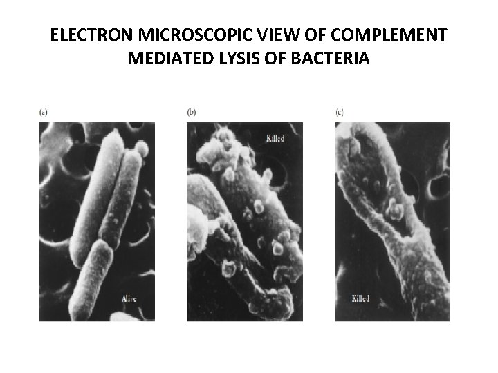 ELECTRON MICROSCOPIC VIEW OF COMPLEMENT MEDIATED LYSIS OF BACTERIA 