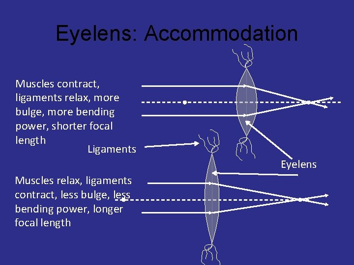 Eyelens: Accommodation Muscles contract, ligaments relax, more bulge, more bending power, shorter focal length