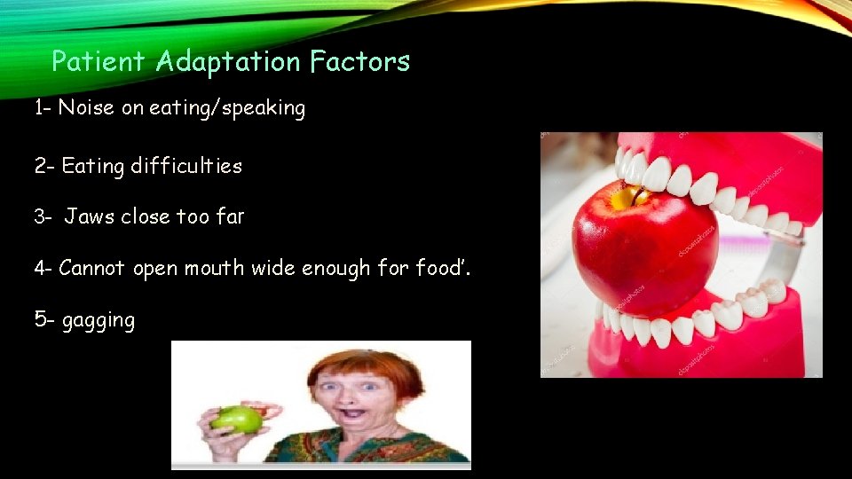 Patient Adaptation Factors 1 - Noise on eating/speaking 2 - Eating difficulties 3 -