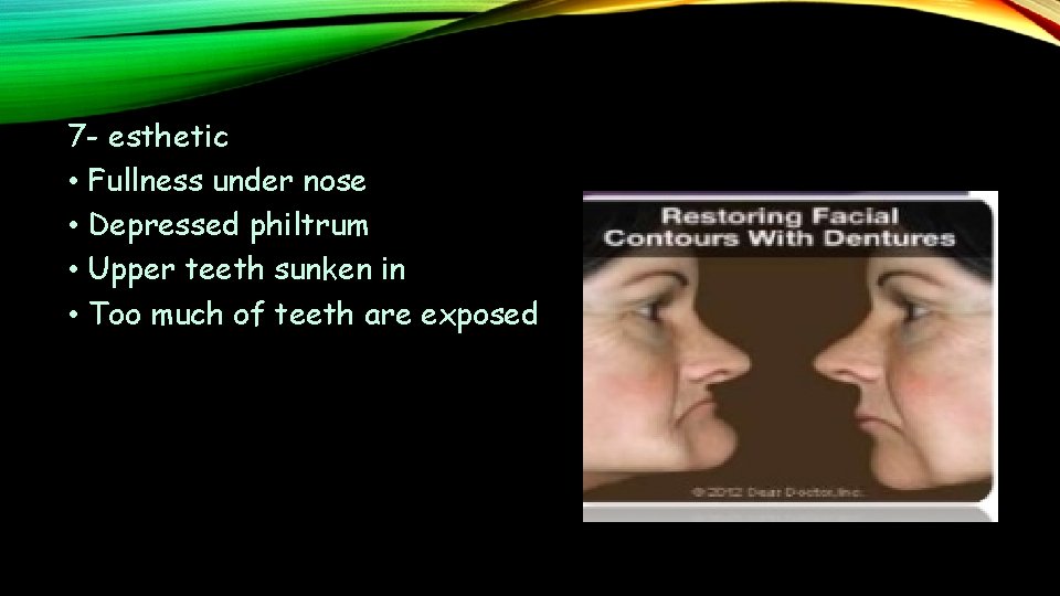 7 - esthetic • Fullness under nose • Depressed philtrum • Upper teeth sunken