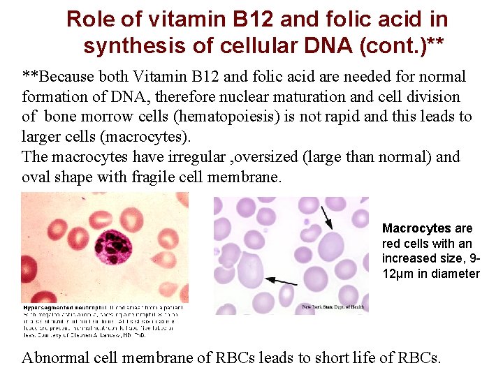 Role of vitamin B 12 and folic acid in synthesis of cellular DNA (cont.