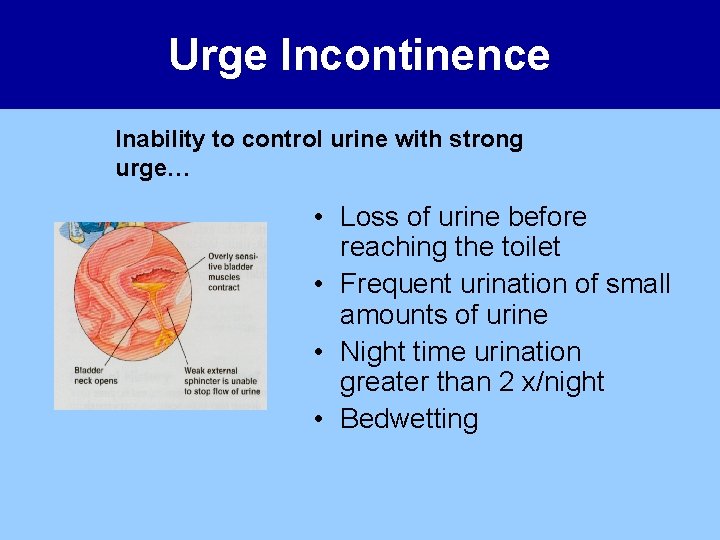 Urge Incontinence Inability to control urine with strong urge… • Loss of urine before