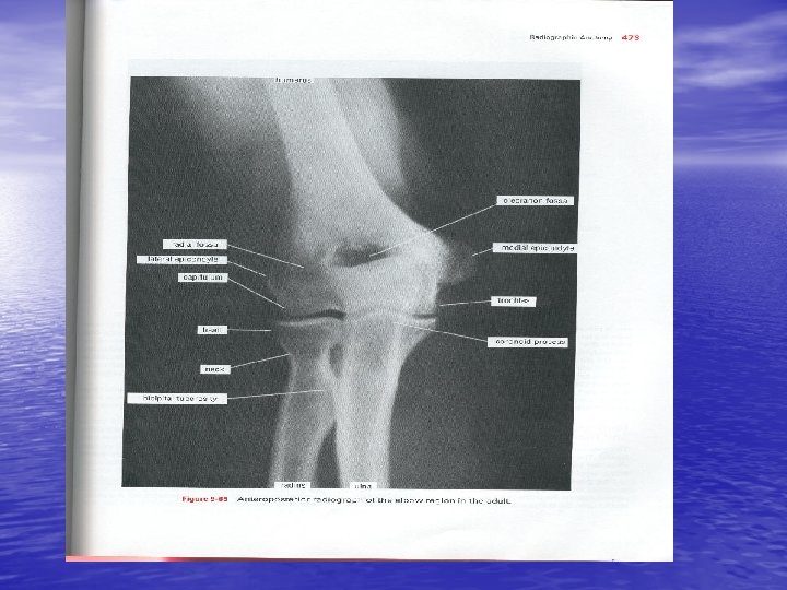 SnellUpper limb473. jpg 3 