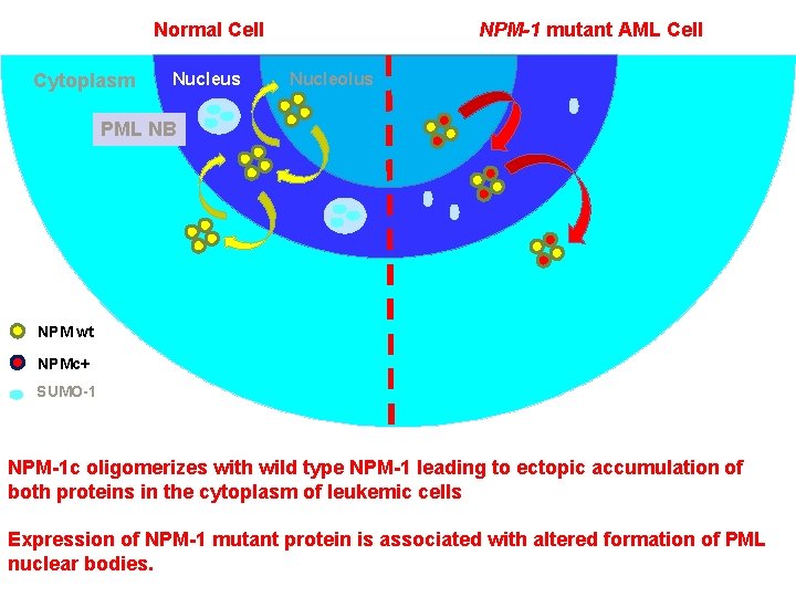 Normal Cell Cytoplasm Nucleus NPM-1 mutant AML Cell Nucleolus PML NB NPM wt NPMc+