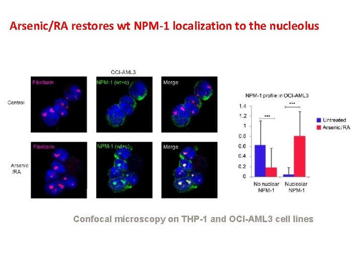 Arsenic/RA restores wt NPM-1 localization to the nucleolus Confocal microscopy on THP-1 and OCI-AML