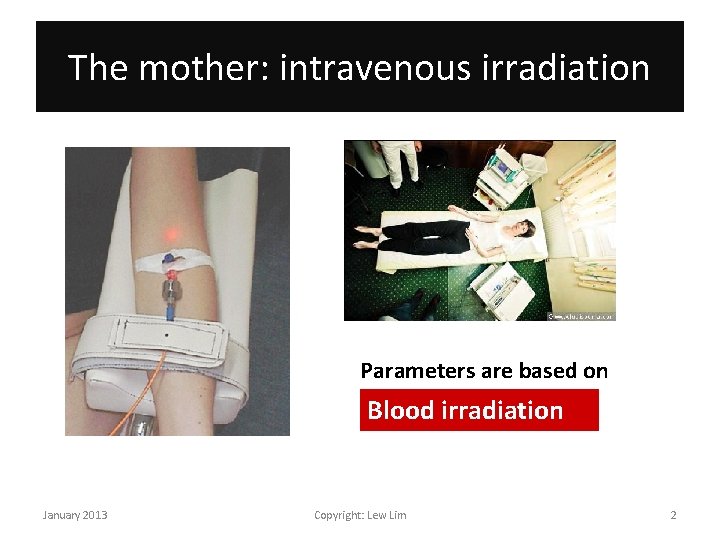The mother: intravenous irradiation Parameters are based on Blood irradiation January 2013 Copyright: Lew