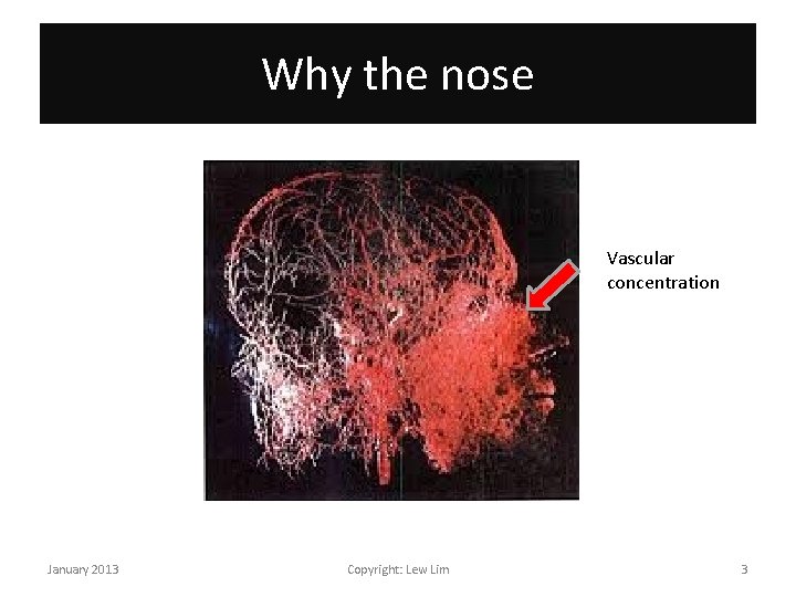 Why the nose Vascular concentration January 2013 Copyright: Lew Lim 3 