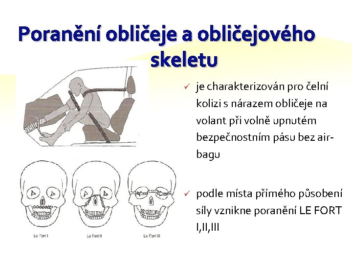 Poranění obličeje a obličejového skeletu ü je charakterizován pro čelní kolizi s nárazem obličeje