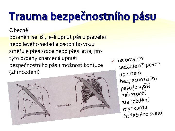 Trauma bezpečnostního pásu Obecně: poranění se liší, je-li upnut pás u pravého nebo levého