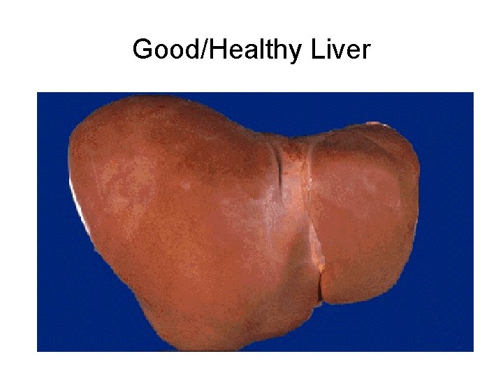 Good/Healthy Liver 