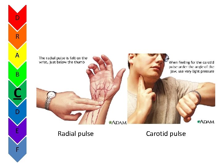 D R A B C D E F Radial pulse Carotid pulse 