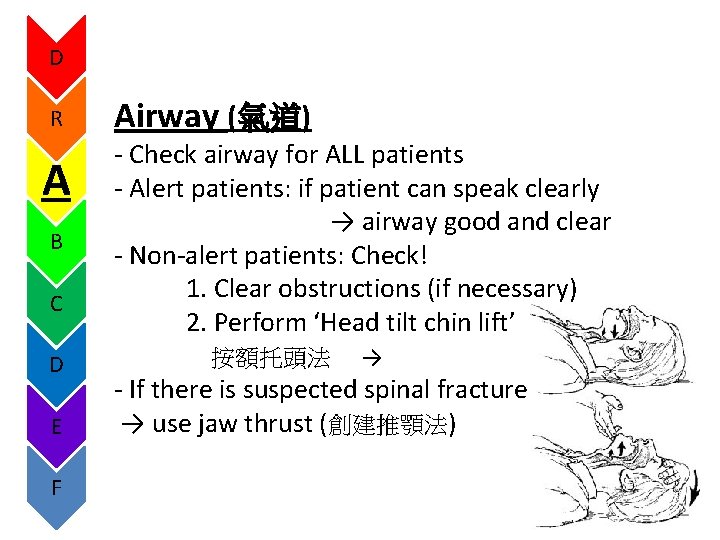 D R A B C D E F Airway (氣道) - Check airway for