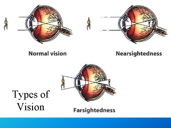 Types of Vision 