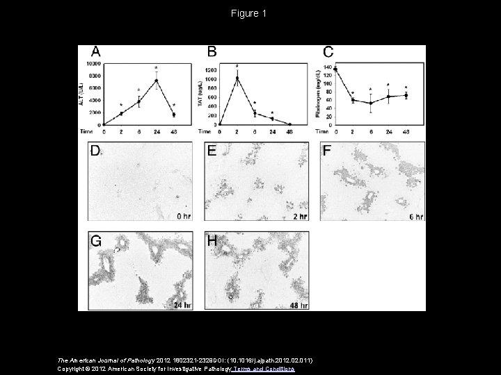 Figure 1 The American Journal of Pathology 2012 1802321 -2329 DOI: (10. 1016/j. ajpath.