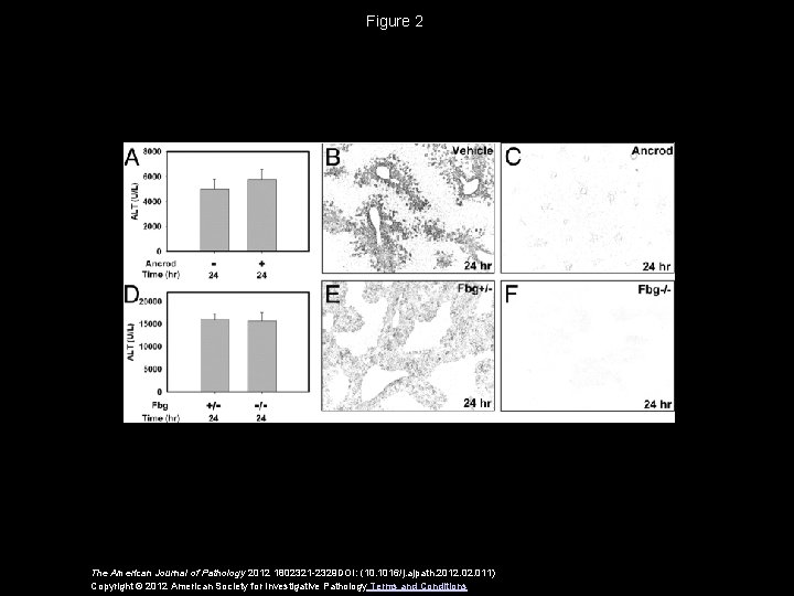 Figure 2 The American Journal of Pathology 2012 1802321 -2329 DOI: (10. 1016/j. ajpath.